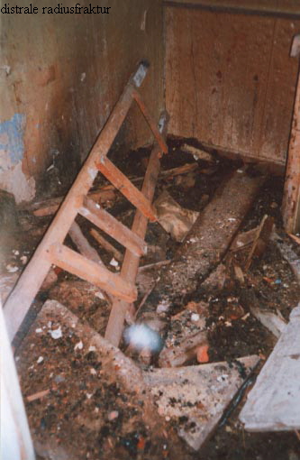 distrale radiusfraktur